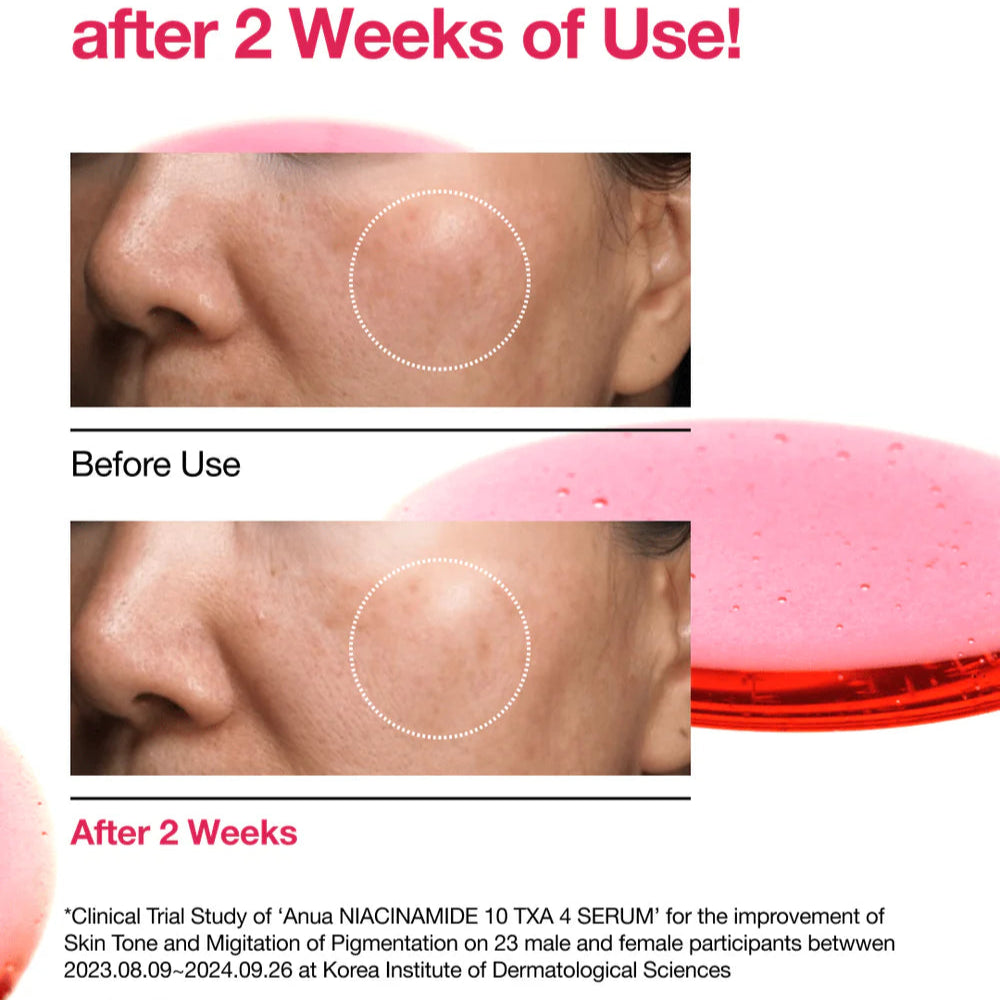 ANUA - Niacinamide E 10%+TXA 4% - Serum - v5 - Seoulful Skincare