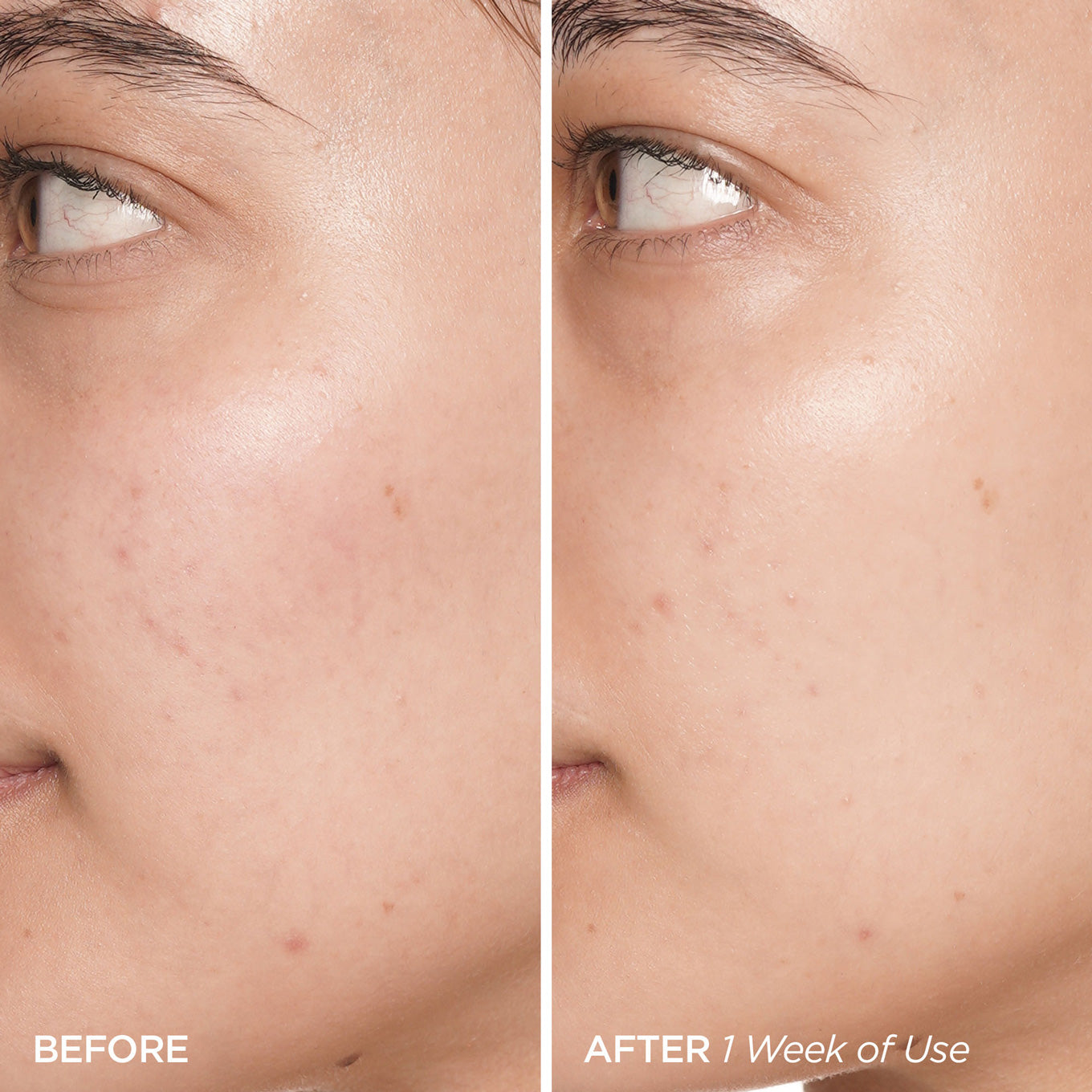 AXIIS-Y_-_PHA_Resurfacing_Glow_Peel_50ml_5-_Seoulful_Skincare