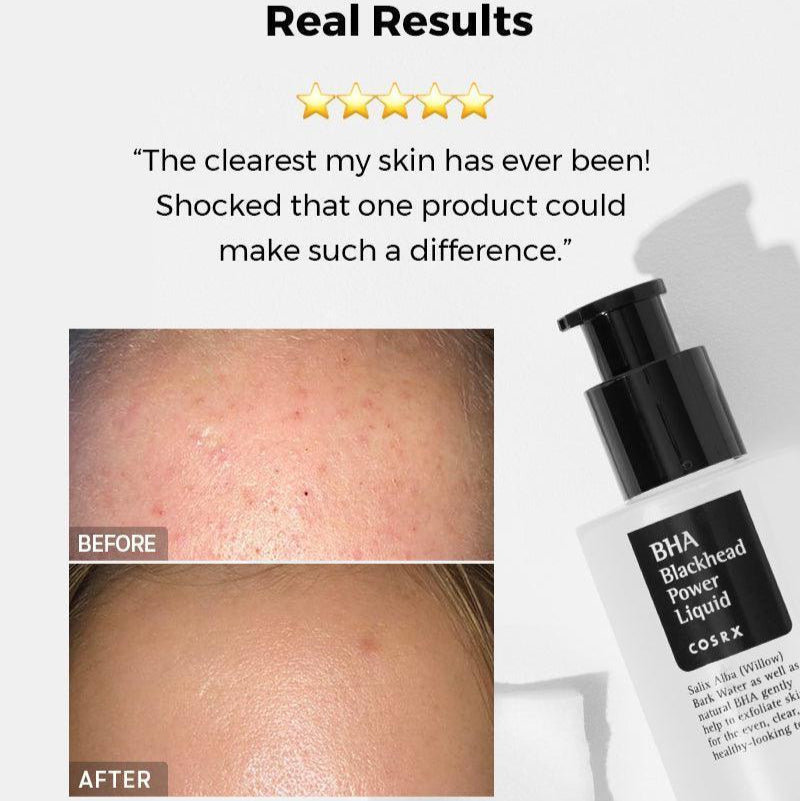 COSRX - BHA Blackhead Power Liquid - v - Seoulful Skincare