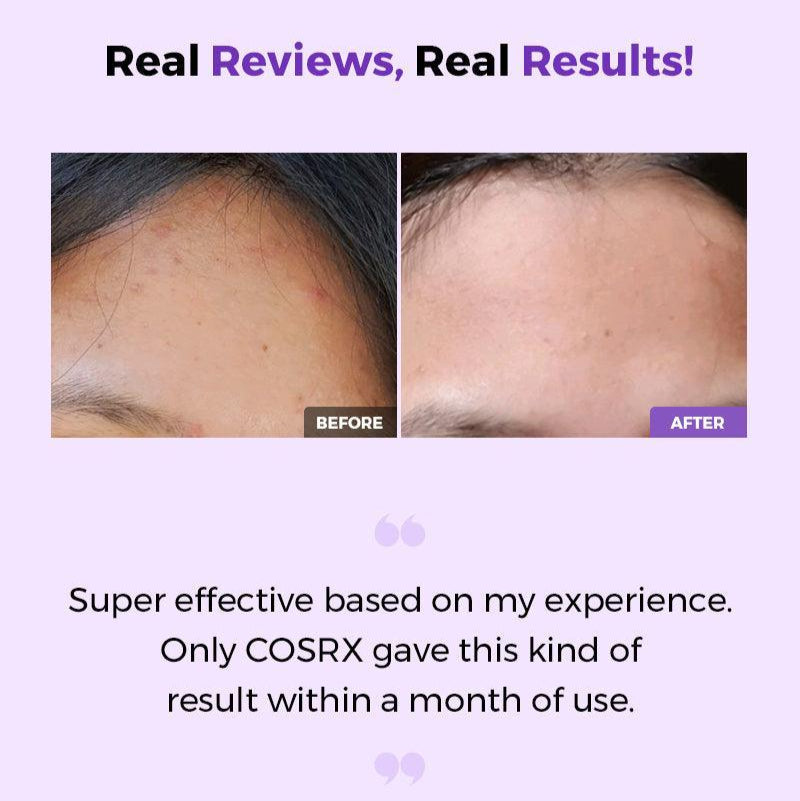 Cosrx - AHA/BHA Clarifying Treatment Toner - v - Seoulful Skincare