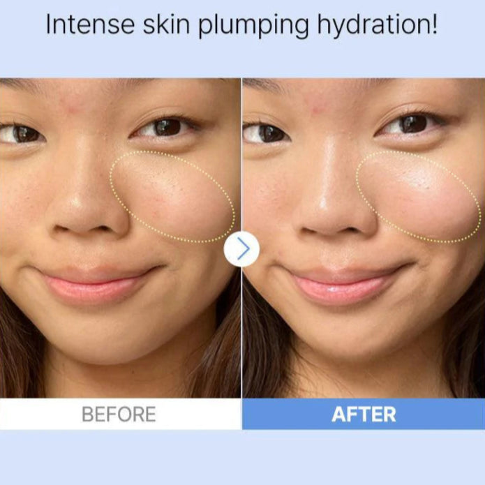Cosrx - The Hyaluronic Acid 3 Serum (20ml) - v2 - Seoulful Skincare