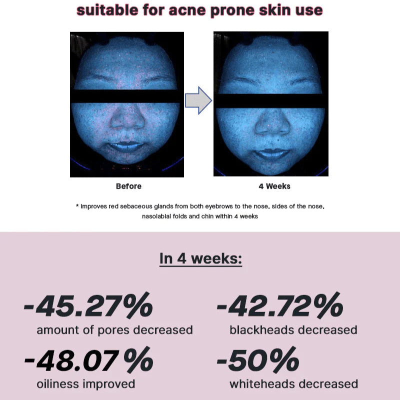 Cosrx - The Niacinamide 15 Serum (20ml) - v2 - Seoulful Skincare