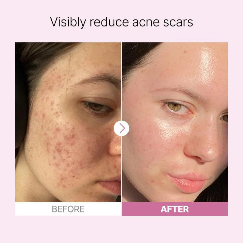 Cosrx - The Niacinamide 15 Serum (20ml) - v3 - Seoulful Skincare
