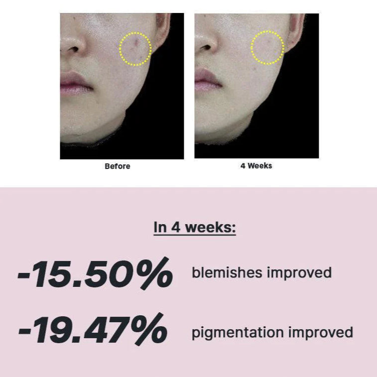 Cosrx - The Niacinamide 15 Serum (20ml) - v - Seoulful Skincare