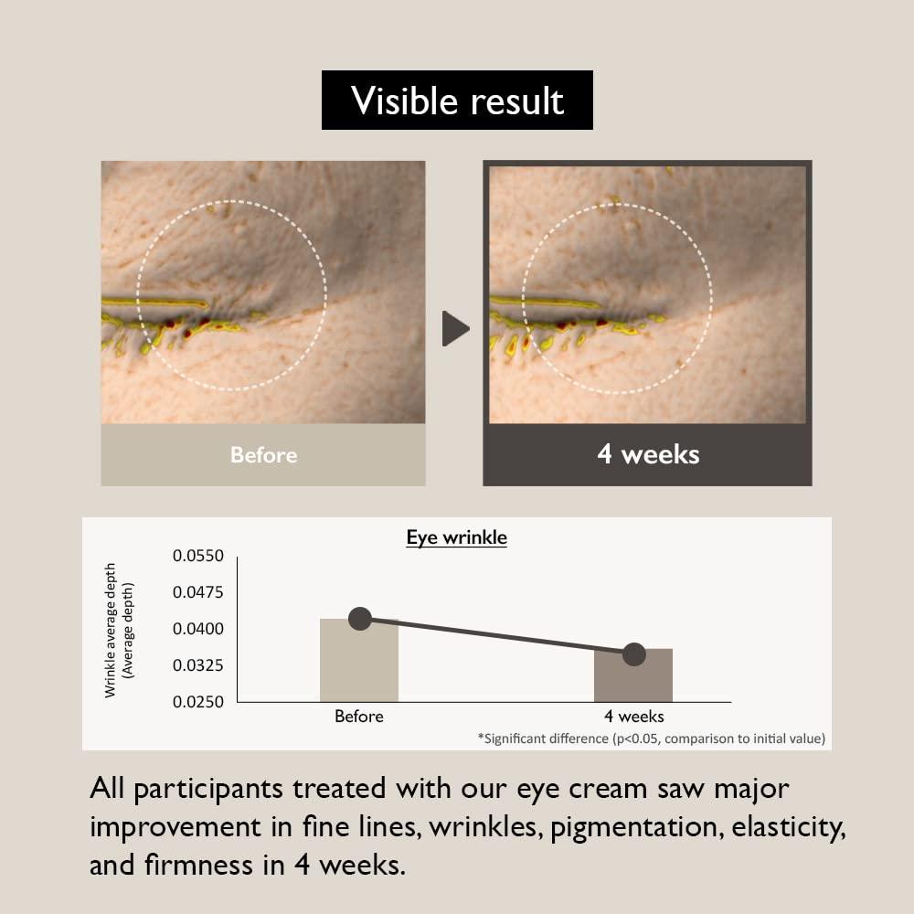 Haruharu_Wonder_-_Black_Rice_Bakuchiol_Eye_Cream_20ml_results_-_Seoulful_Skincare