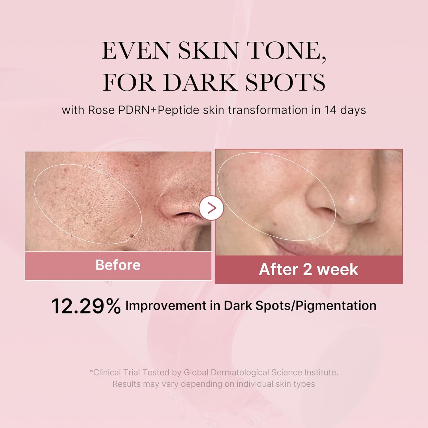 Medciube_-_PDRN_Pink_CICA_Soothing_Toner_250ml_Info 3-_Seoulful_Skincare