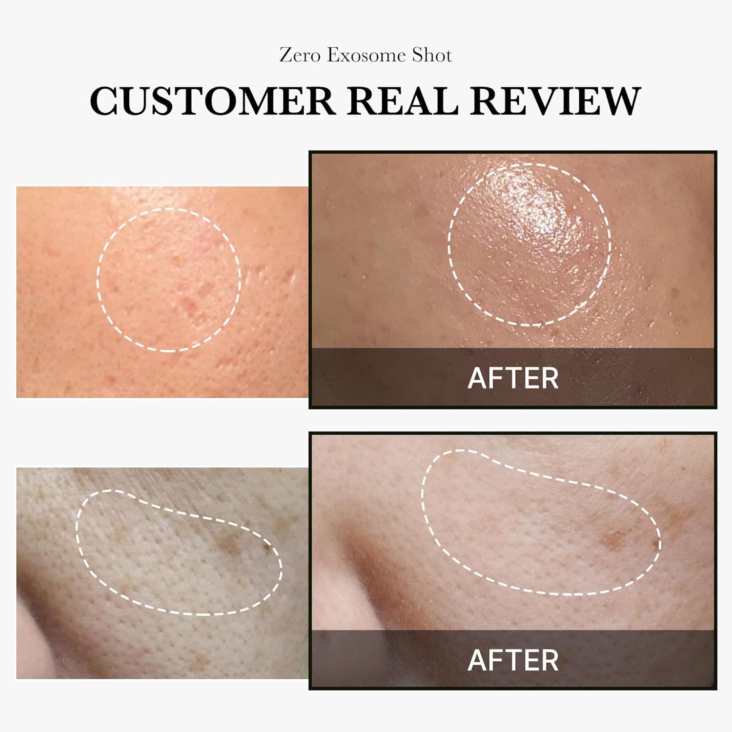 Medciube_-_Zero_Exosome_Shot_2000_30ml_9-_Seoulful_SKincare