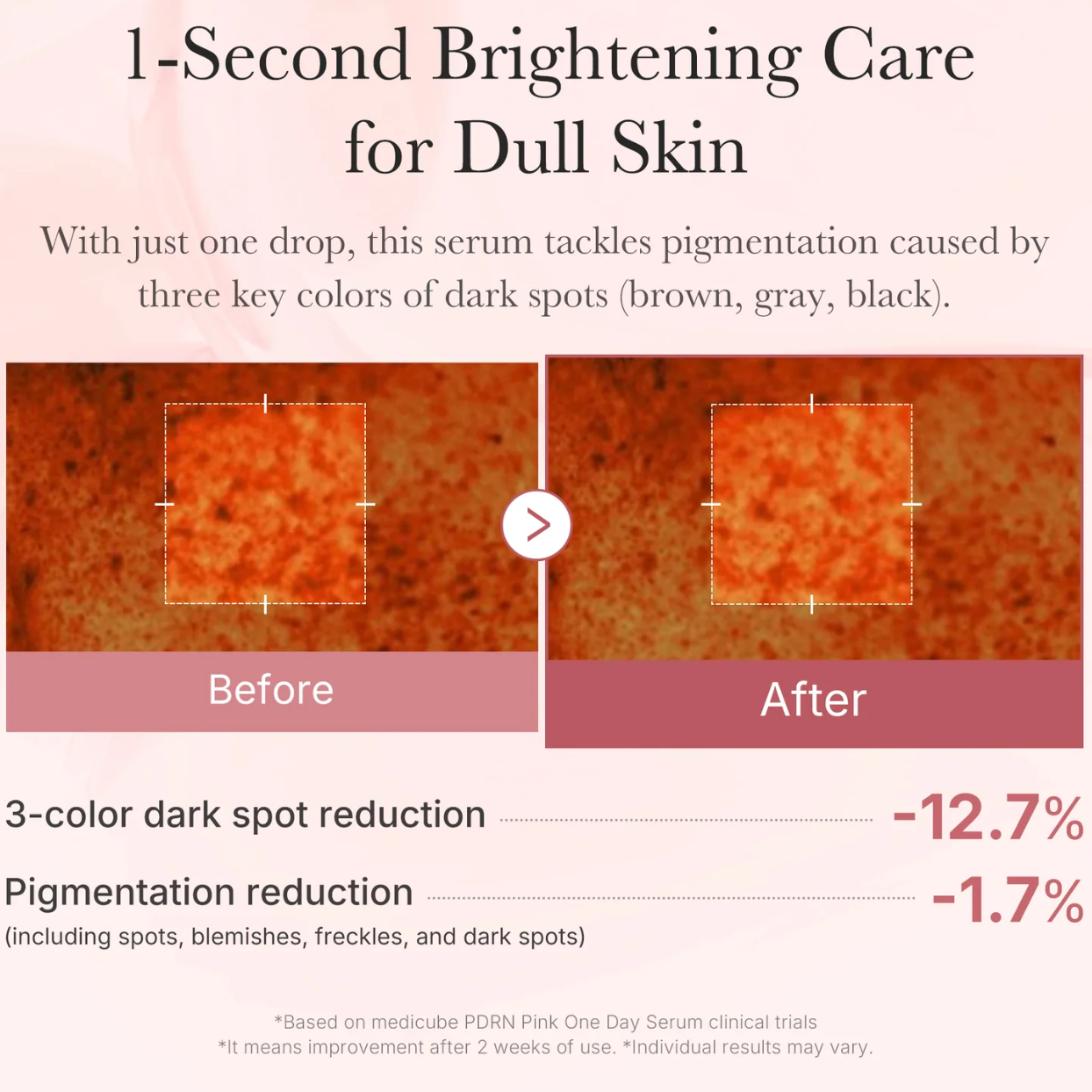 Medicube_-PDRN_Pink_One_Day_Serum_10_x_1.5ml_5-_Seoulful_Skincare