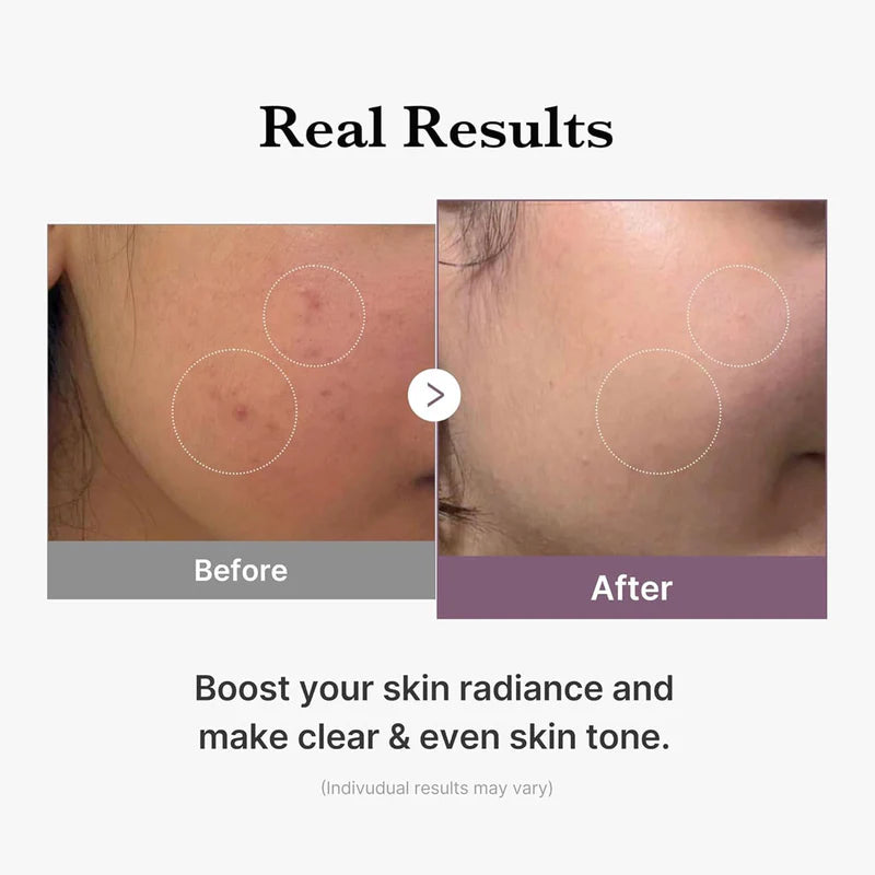 Medicube_-_Glutathione_Glow_Toner_140ml_Info4-_Seoulful_Skincare