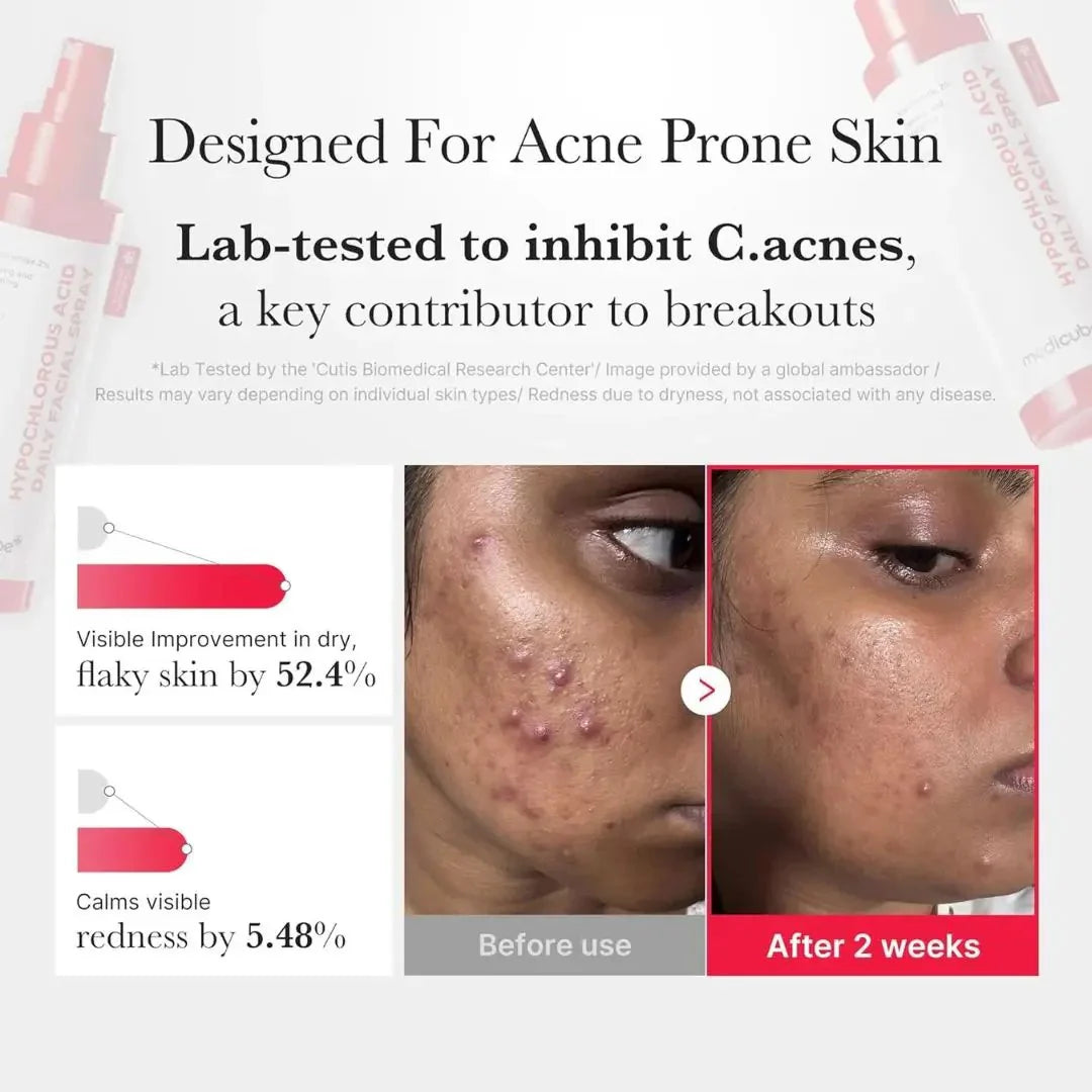 Medicube - Hypochlorous Acid Daily Facial Spray (50ml) 6 - Seoulful Skincare