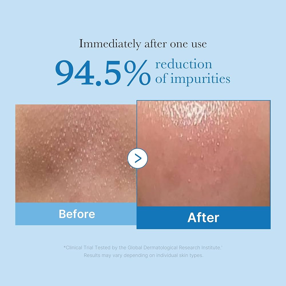Medicube_-_Zero_Pore_Blackhead_Deep_Cleansing_Oil_205ml_5-_Seoulful_Skincare