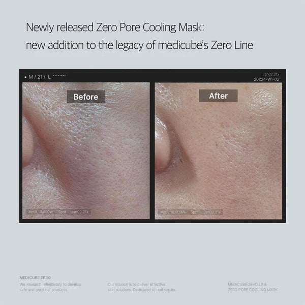 Medicube_-_Zero_Pore_Cooling_Mask_1ea_3-_Seoulful_Skincare