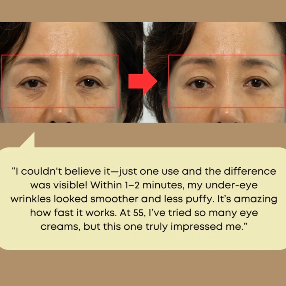 NINE LESS - Ever-Youth Dual Effect Eye Cream (20ml) - v7 - Seoulful Skincare