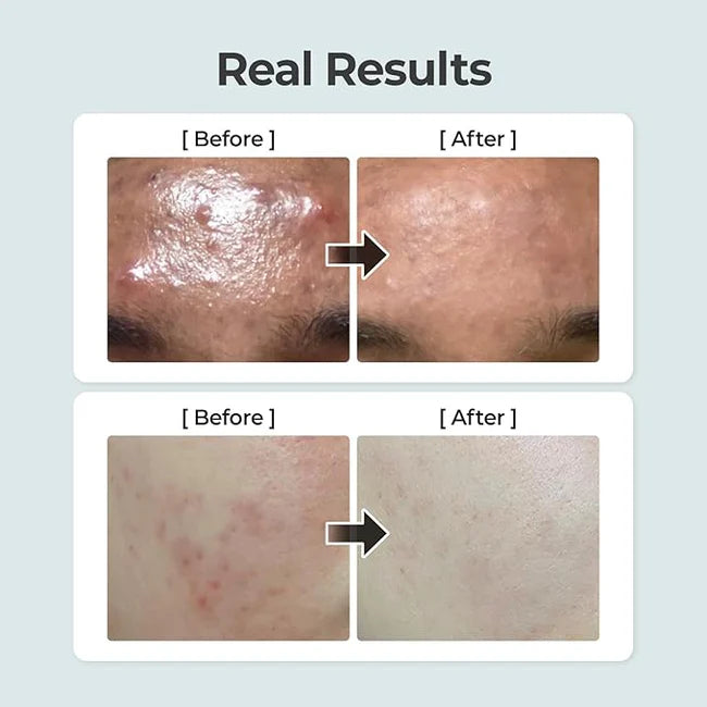 Numbuzin - No.1 Pure-Full Calming Herb Toner (300ml) - v7 - Seoulful Skincare