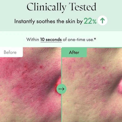 Purito_-_Wonder_Releaf_Centella_Serum_60ml_7-_Seoulful_Skincare