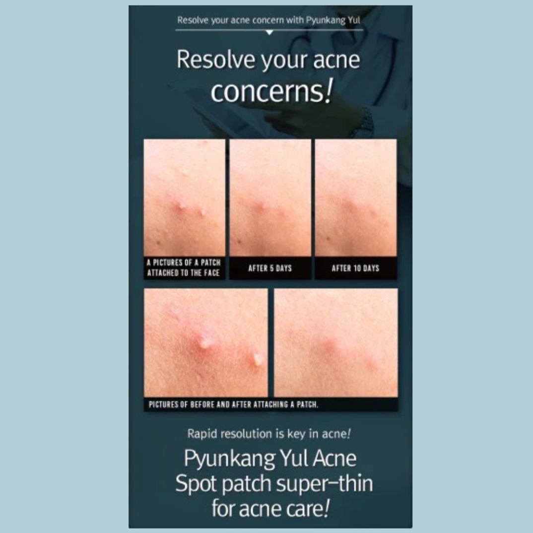 Pyunkang Yul - ACNE Spot Patch Super Thin (15 Patches) Info8- Seoulful Skincare