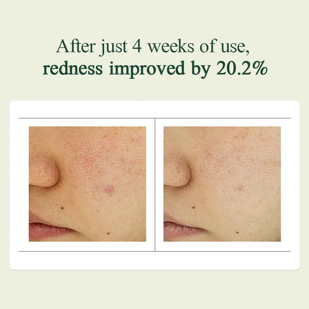 Pyunkang Yul - Calming Madecasoside Spot Cream (30ml) Info3 - Seoulful Skincare