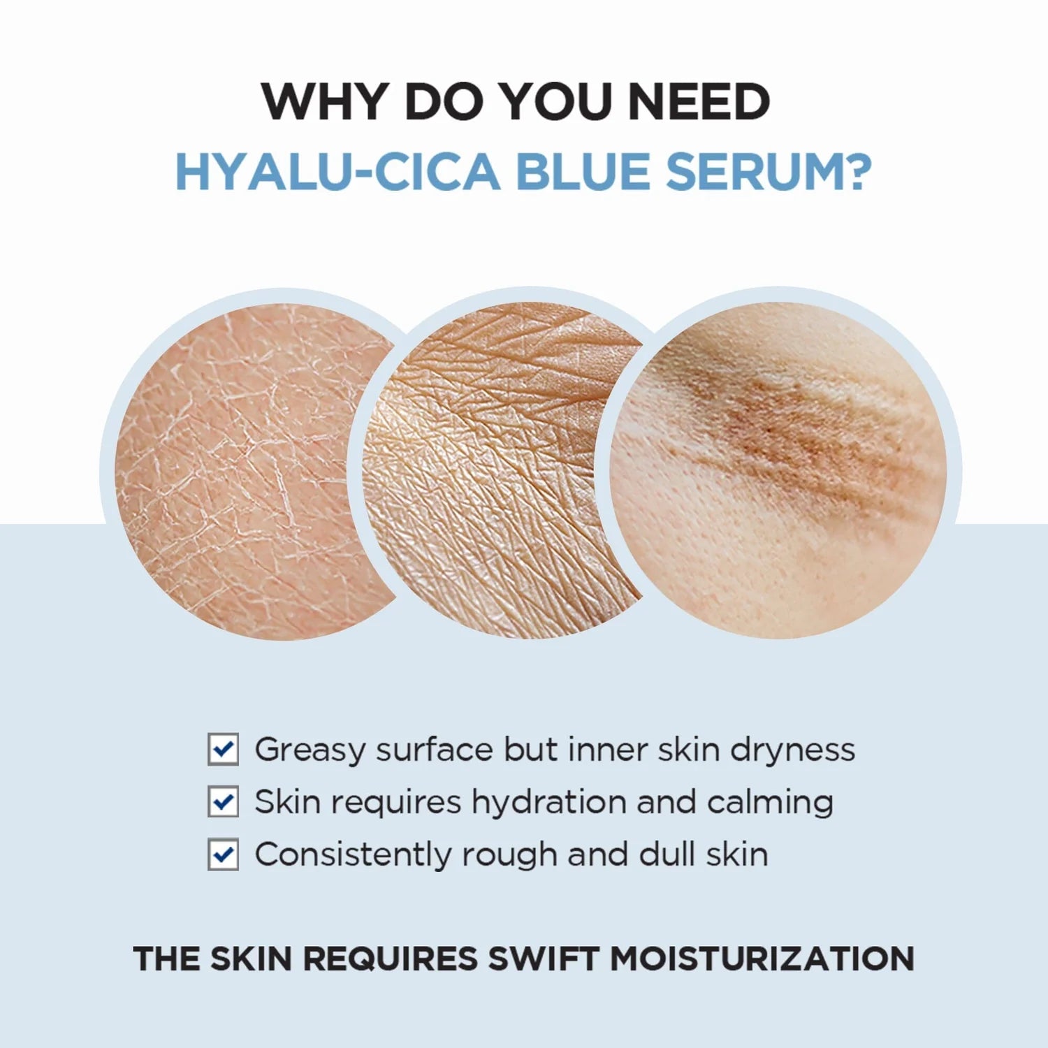 Madagascar Centella Hyalu-Cica Blue Serum (30ml/50ml)