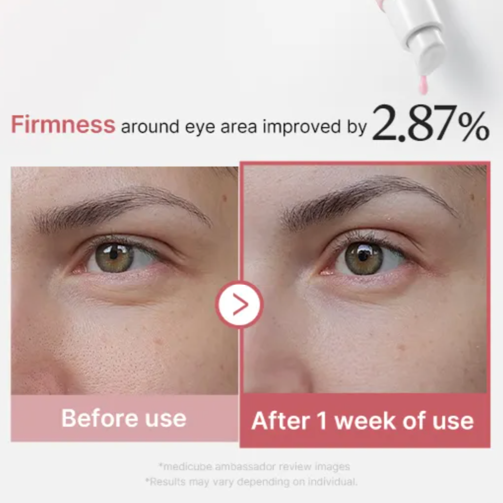PDRN Pink Peptide Eye Cream (30ml)