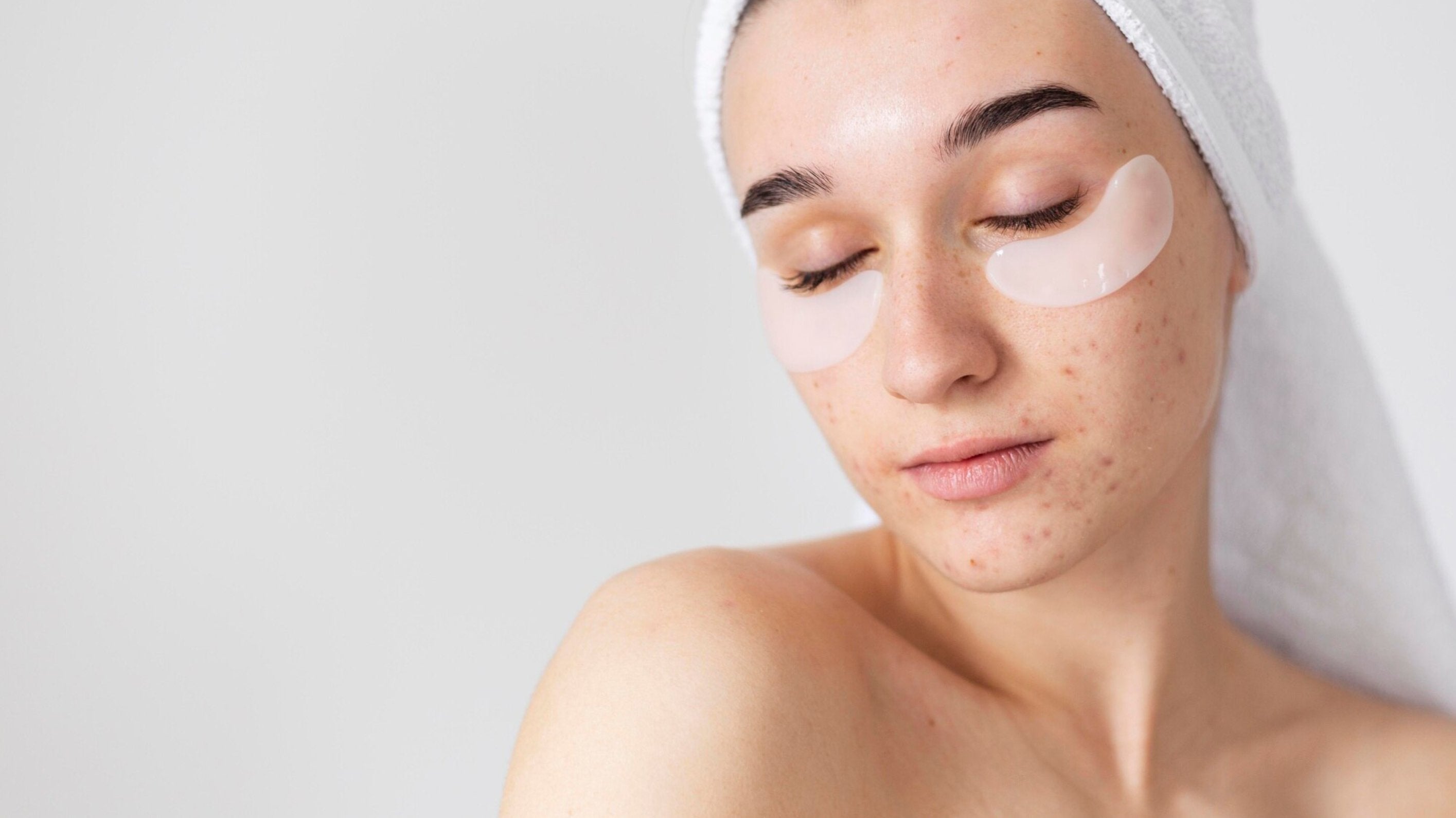 Korean Skincare South Africa - Acne-Prone Skin - Seoulful Skincare
