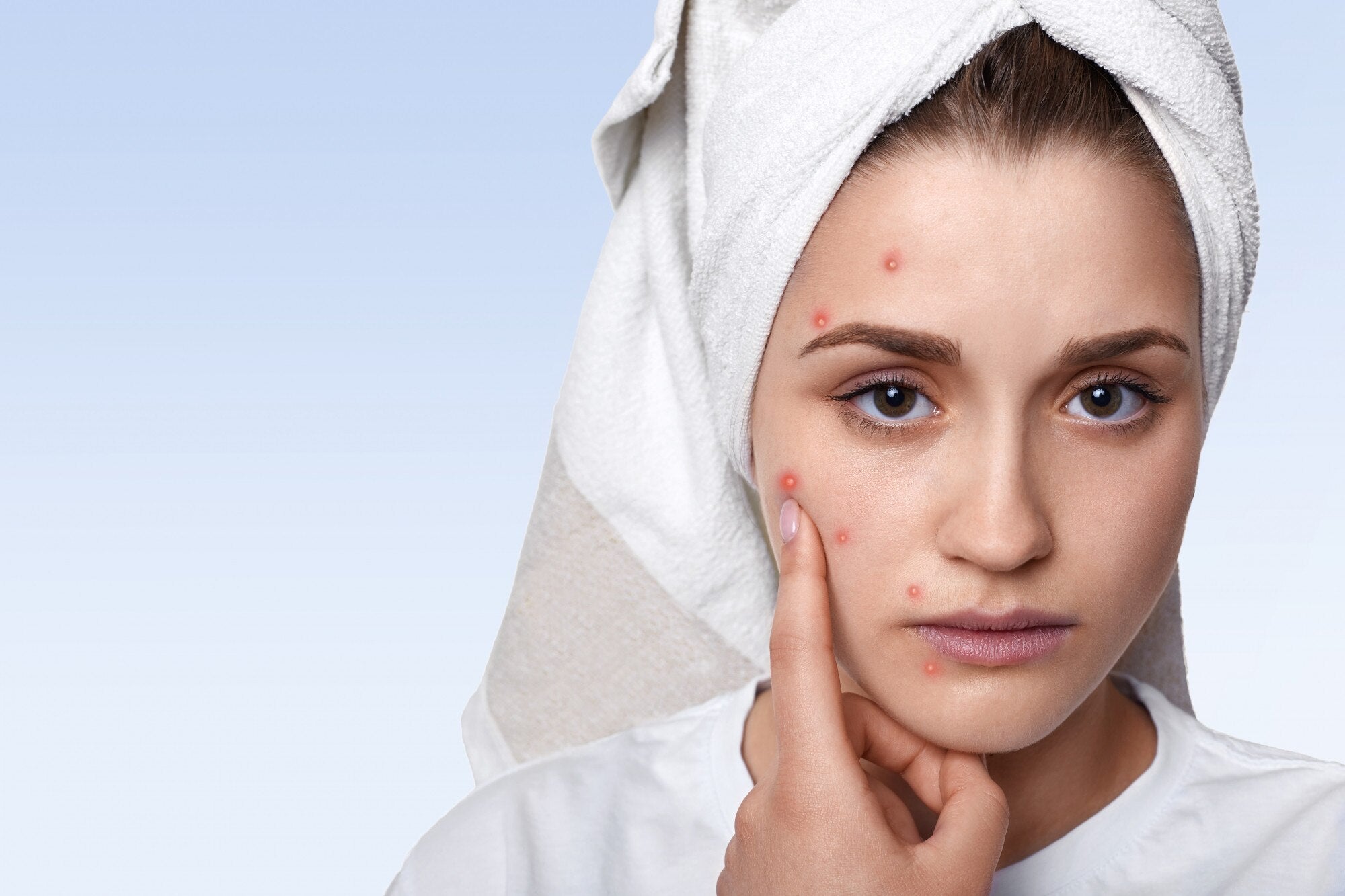 Korean Skincare SOuth Africa - Spot Treatment - Seoulful Skincare