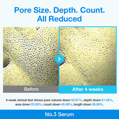 Numbuzin - No.3 Blue Bio-Retinol Pore Refining Serum - v2 - Seoulful Skincare