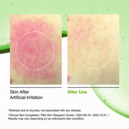 ANUA - Azelaic Acid 10 Hyaluron Redness Soothing Serum (30ml) - v4 - Seoulful Skincare