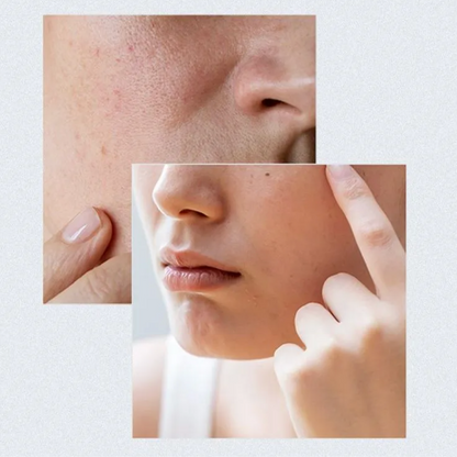 ANUA - Birch Moisture Boosting Pad (160ml) - v24 - Seoulful Skincare