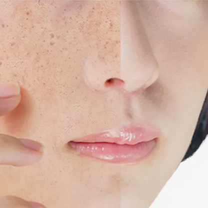 ANUA - Green Lemon Vita C Blemish Serum Mask (1pc) - v3 - Seoulful Skincare