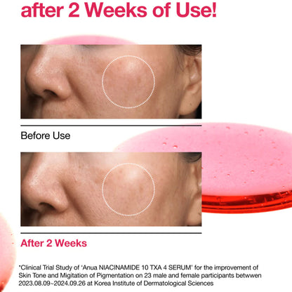 ANUA - Niacinamide E 10%+TXA 4% - Serum - v5 - Seoulful Skincare