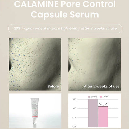 AXIS-Y_-_Calamine_Pore_Control_Capsule_Serum_50ml_Info 2-_Seoulful_Skincare