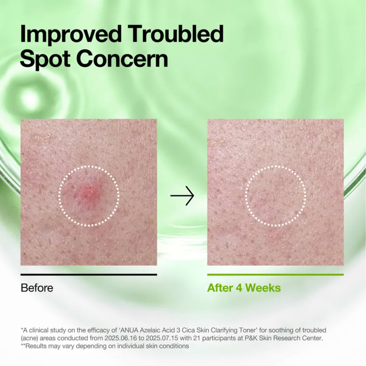 Anua - Azelaic Acid 3 CICA Skin Clarifying Toner (250ml) - v8 - Seoulful Skincare