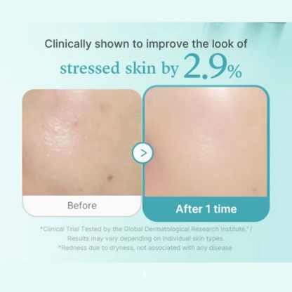 Azelaic Acid Exosome Shot 7500 (30ml) - v8 - Seoulful Skincare