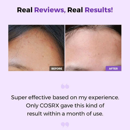 Cosrx - AHA/BHA Clarifying Treatment Toner - v - Seoulful Skincare