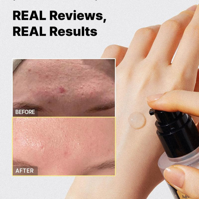 Cosrx - Advanced Snail 96 Mucin Power Essence (30ml / 100 ml) - v2 - Seoulful Skincare