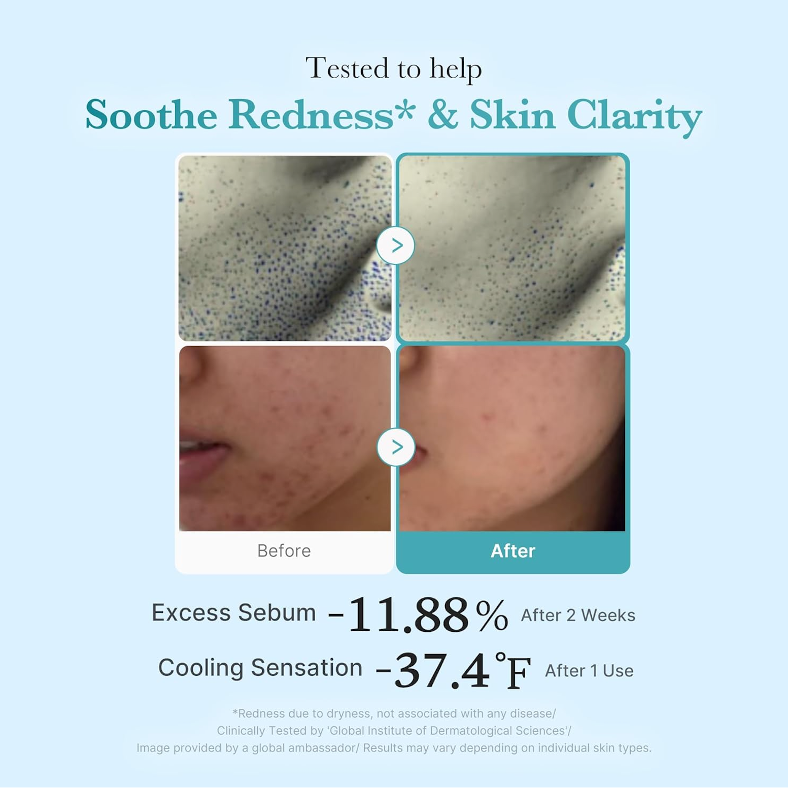 Medicube - Azelaic Acid Niacinamide Clear Toner - v8 - Seoulful Skincare