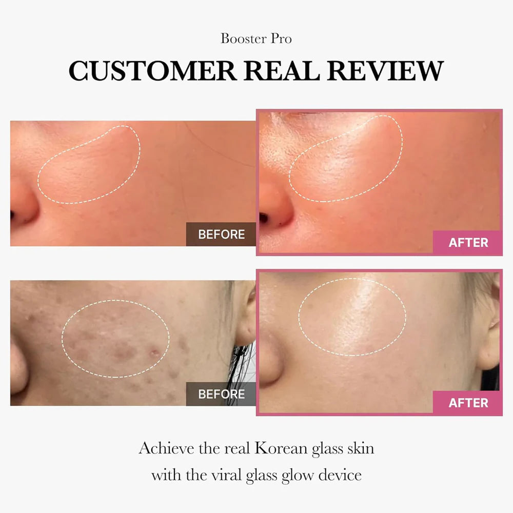Medicube_-_Booster_Pro_Review-_Seoulful_SKincare