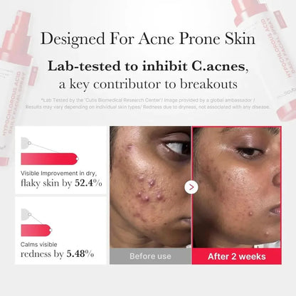 Medicube - Hypochlorous Acid Daily Facial Spray (50ml) 6 - Seoulful Skincare