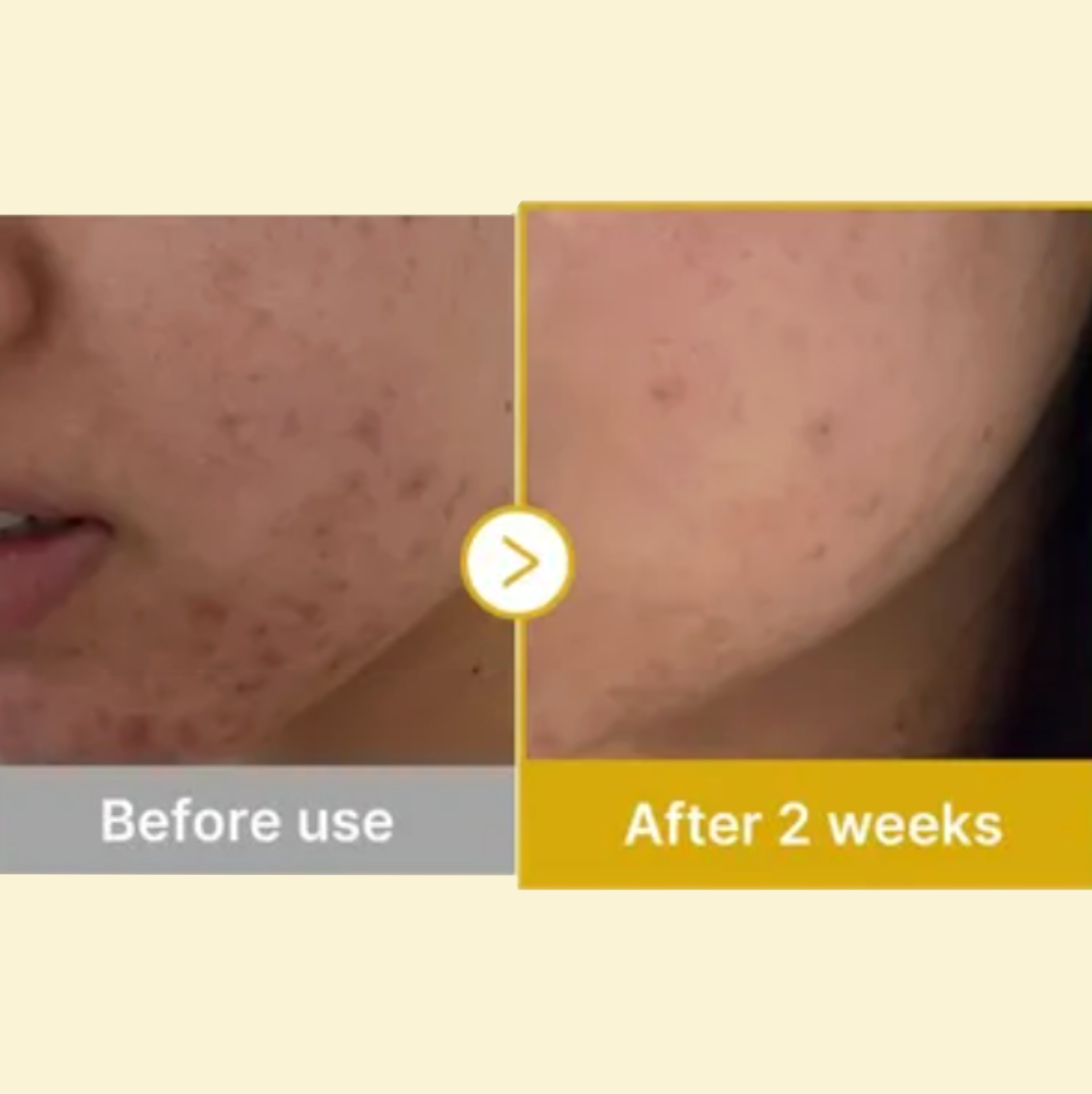 Medicube - Kojic Acid Turmeric Pad (70 pads) - v9 - Seoulful Skincare