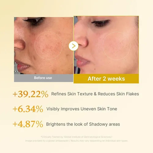 Medicube - Kojic Acid Turmeric Resurfacing Toner (250ml) 2 - Seoulful Skincare