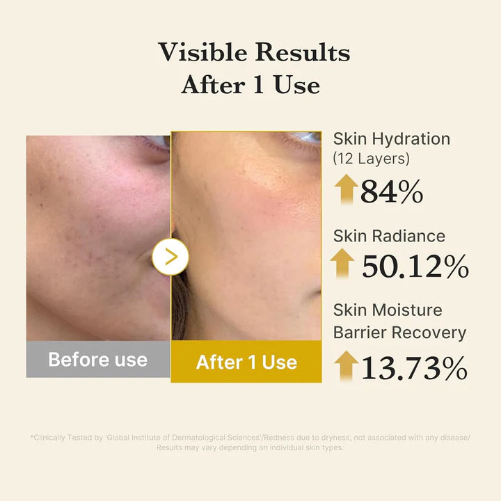 Medicube - Kojic Acid Turmeric Vita Jelly Mist Serum (100ml) 2 - Seoulful Skincare