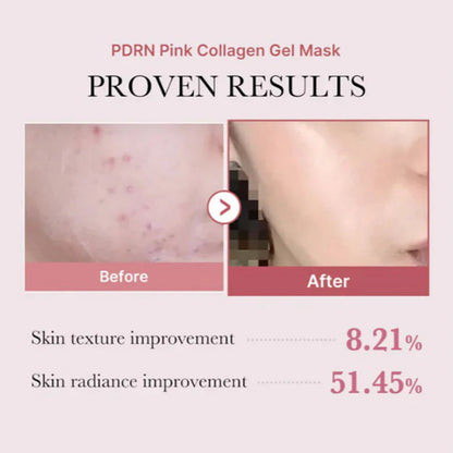 Medicube_-_PDRN_Pink_Collagen_Gel_Mask_1ea_2-_Seoulful_Skincare