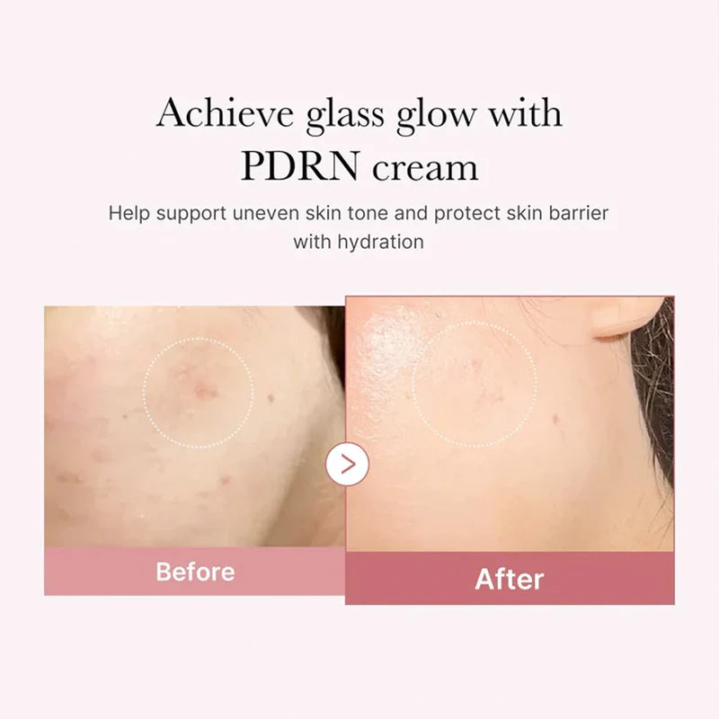 PDRN Pink Hyaluronic Moisturising Cream (50ml)