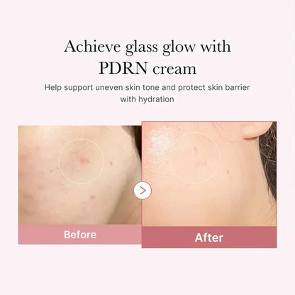 PDRN Pink Hyaluronic Moisturising Cream (50ml)
