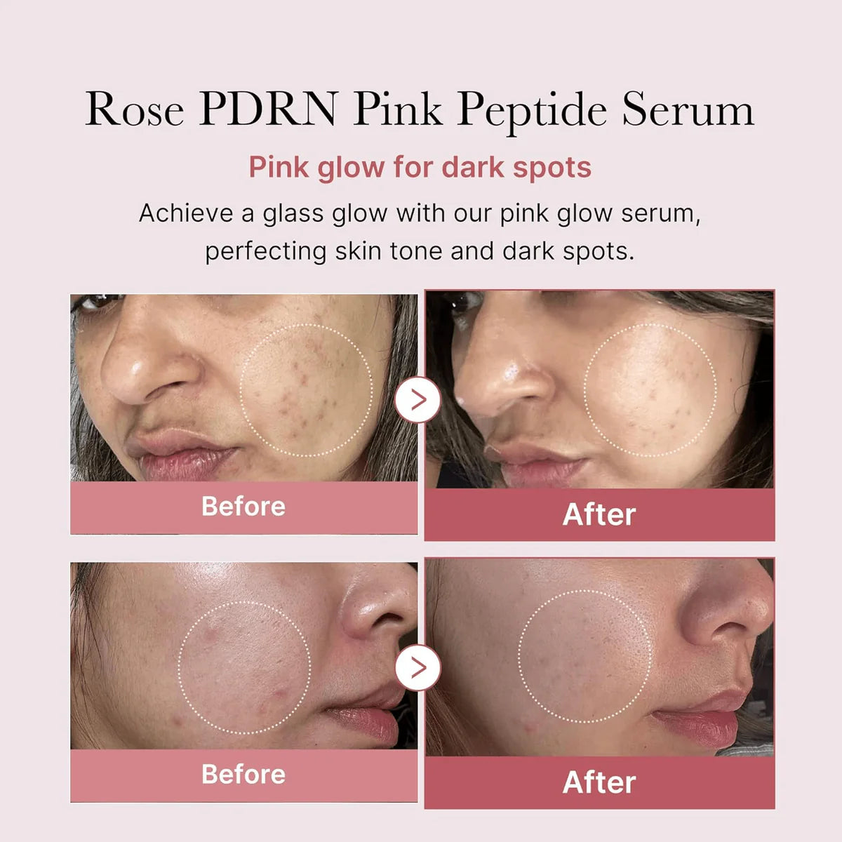 Medicube_-_PDRN_Pink_Peptide_Glow_Serum_30ml_2-_Seoulful_Skincare