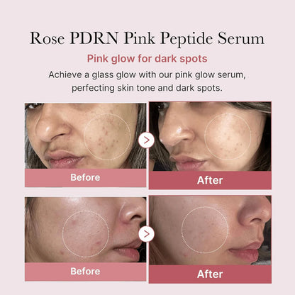 Medicube_-_PDRN_Pink_Peptide_Glow_Serum_30ml_2-_Seoulful_Skincare