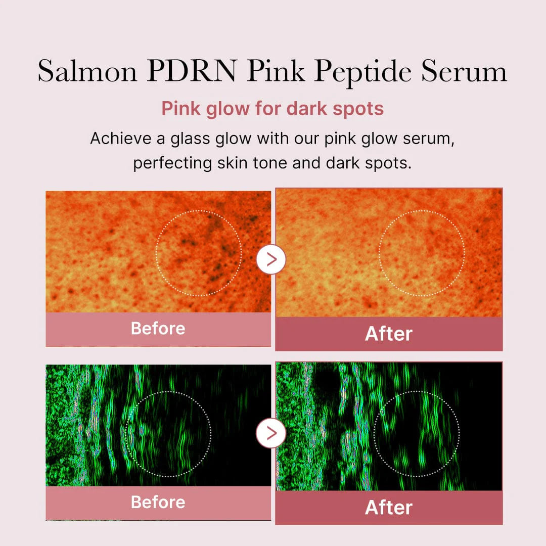 Medicube_-_PDRN_Pink_Peptide_Glow_Serum_30ml_5-_Seoulful_Skincare