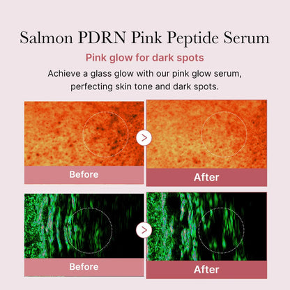 Medicube_-_PDRN_Pink_Peptide_Glow_Serum_30ml_5-_Seoulful_Skincare