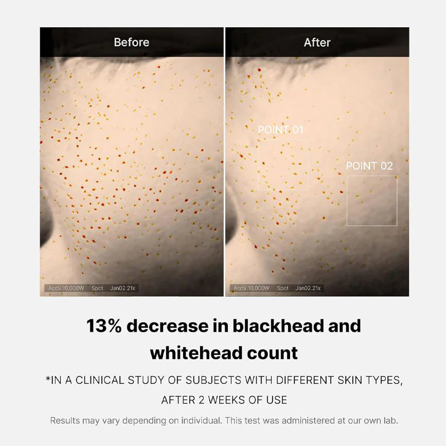 Medicube_-_Zero_Pore_One_Day_Serum_30ml_2-_Seoulful_Skincare