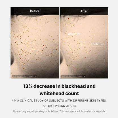 Medicube_-_Zero_Pore_One_Day_Serum_30ml_2-_Seoulful_Skincare